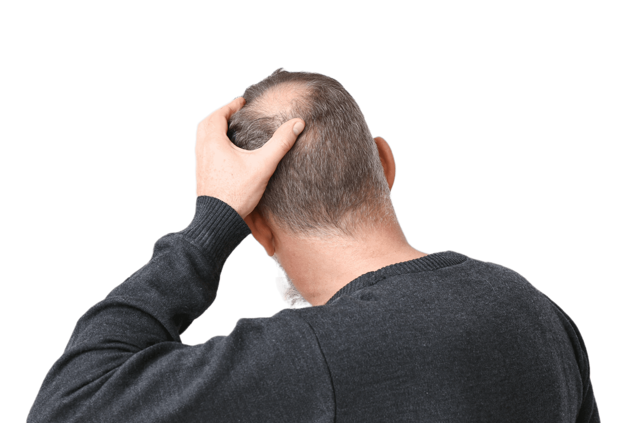 New solutions to stop hair loss - NanoCupper USA