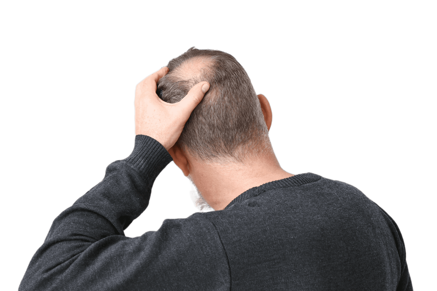 New solutions to stop hair loss - NanoCupper USA
